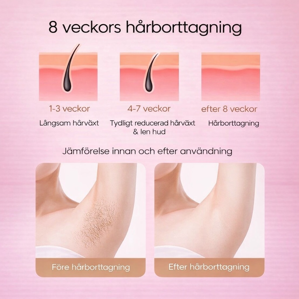 IPL Laser Hårborttagare