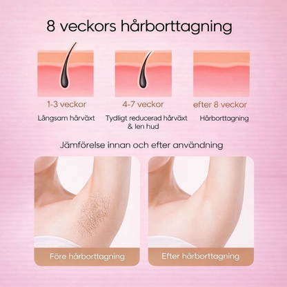 IPL Laser Hårborttagare